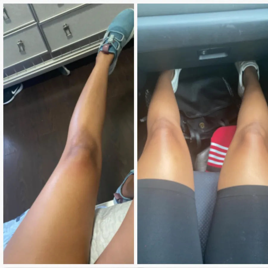 Piernas antes y después
