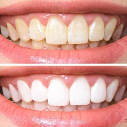 GURUNANDA® - BLANQUEADOR DENTAL DETOX