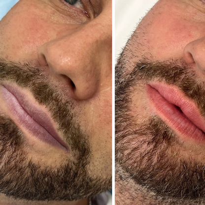 BELANI FORDYCE - LABIOS MÁS SUAVES Y RENOVADOS