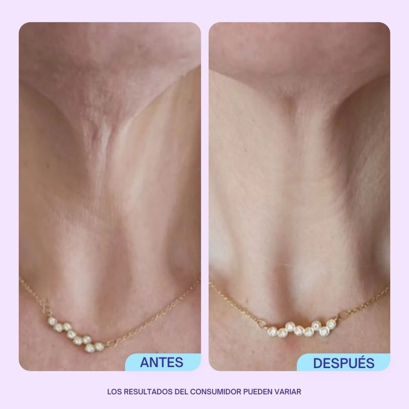 GOPURE® - Crema reafirmante y reafirmante
