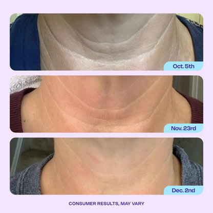 GOPURE® - Crema reafirmante y reafirmante