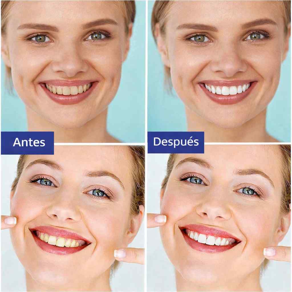 STRIPS WHITE® 2x1- SONRISA MÁS BLANCA DESDE