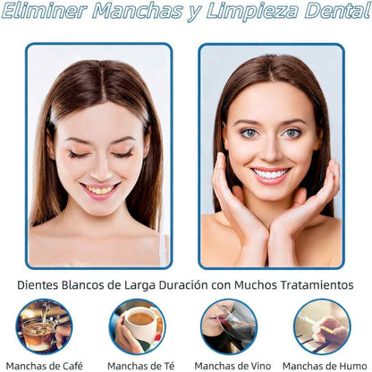 STRIPS WHITE® 2x1- SONRISA MÁS BLANCA DESDE