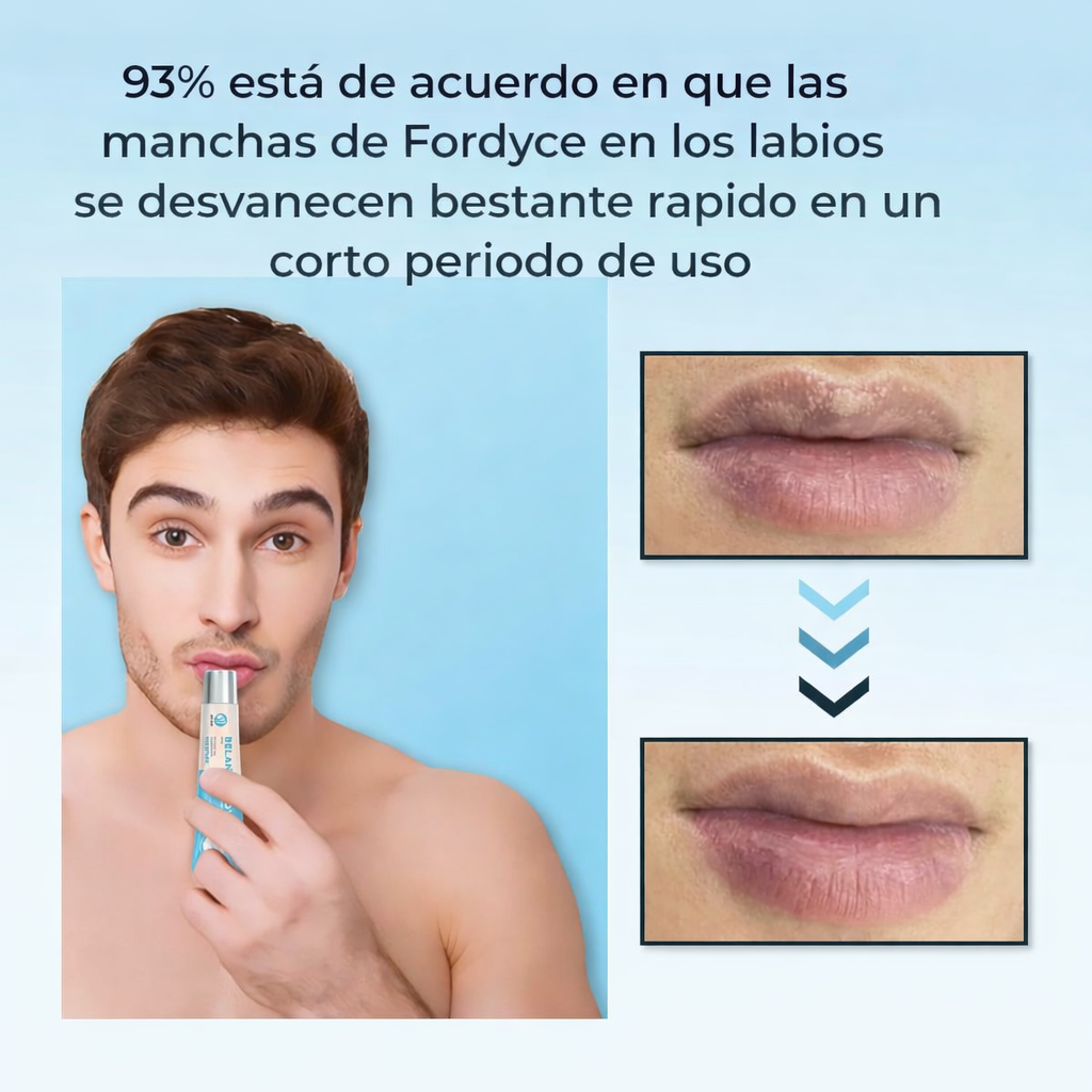 BELANI FORDYCE - LABIOS MÁS SUAVES Y RENOVADOS