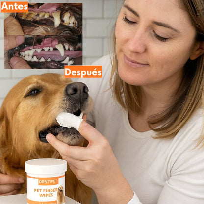 PetTeeth® - Toallitas de higiene dental para mascotas