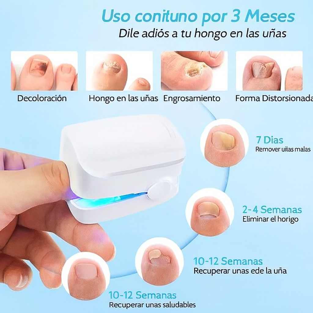 OnicoVital Láser Pro®: Renueva tus Uñas con Tecnología Láser