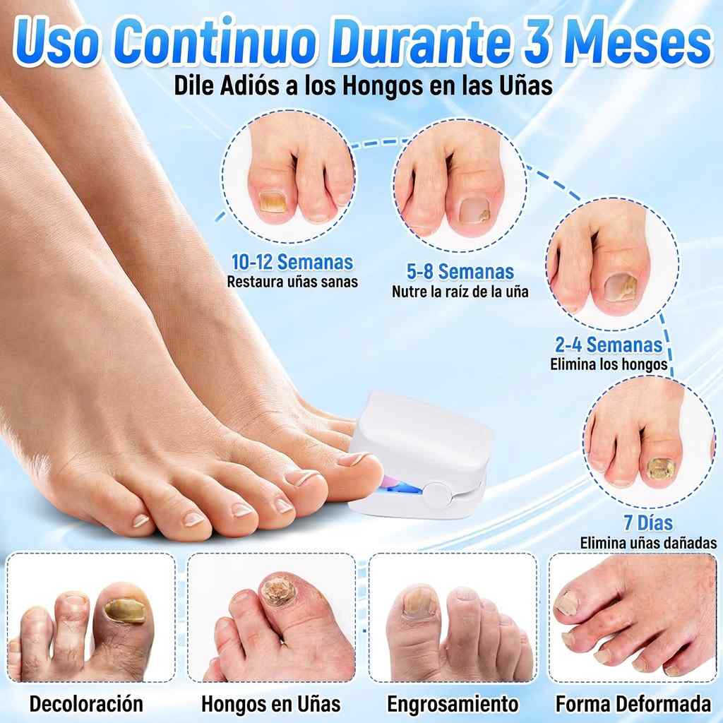 FungiClear™ - Láser Restaurador FungiClear Pro ✨